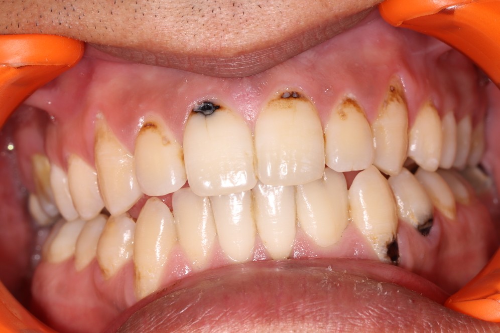 Photo avant l'intervention